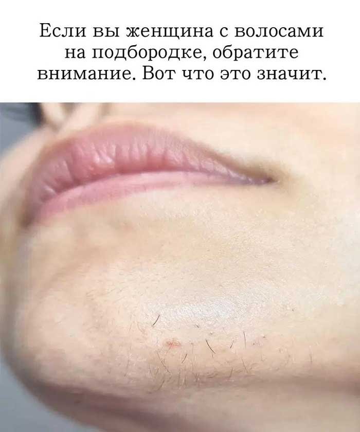 «Если ты женщина и у тебя растут волосы на подбородке — ты не одна. Вот что нужно знать»