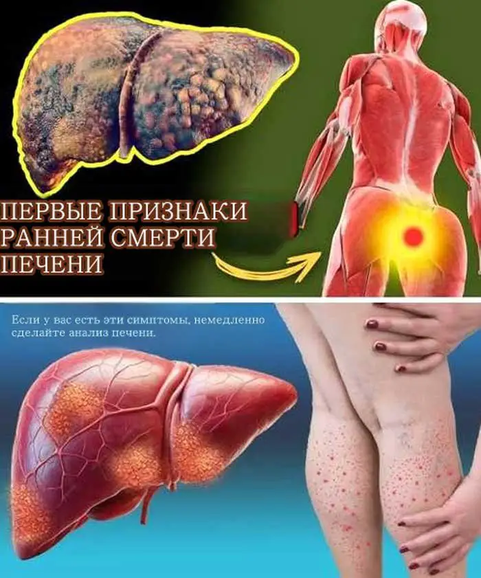 💥 «12 тревожных сигналов, которые ваша печень посылает ежедневно!»