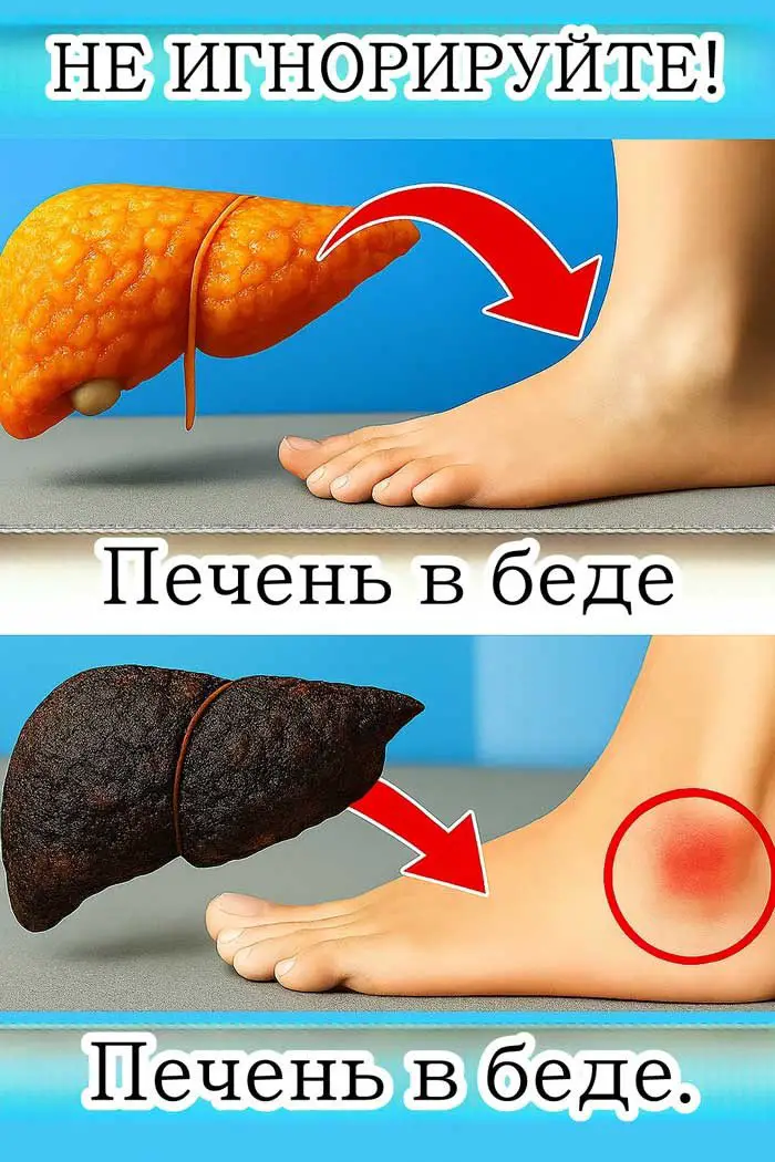 Ваши ноги предупреждают о болезни печени: 5 тревожных сигналов, которые нельзя игнорировать