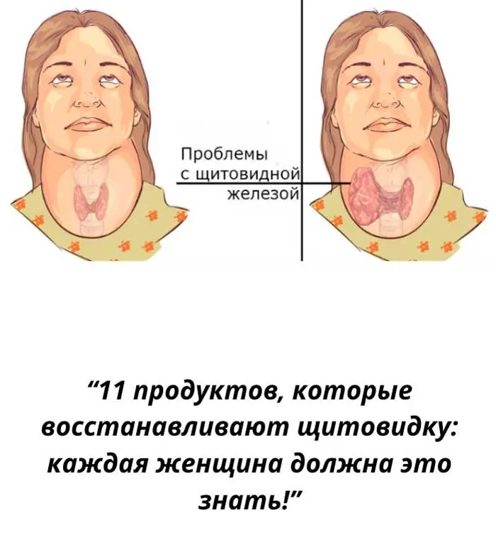 “Щитовидка кричит о помощи! Эти продукты способны её спасти”