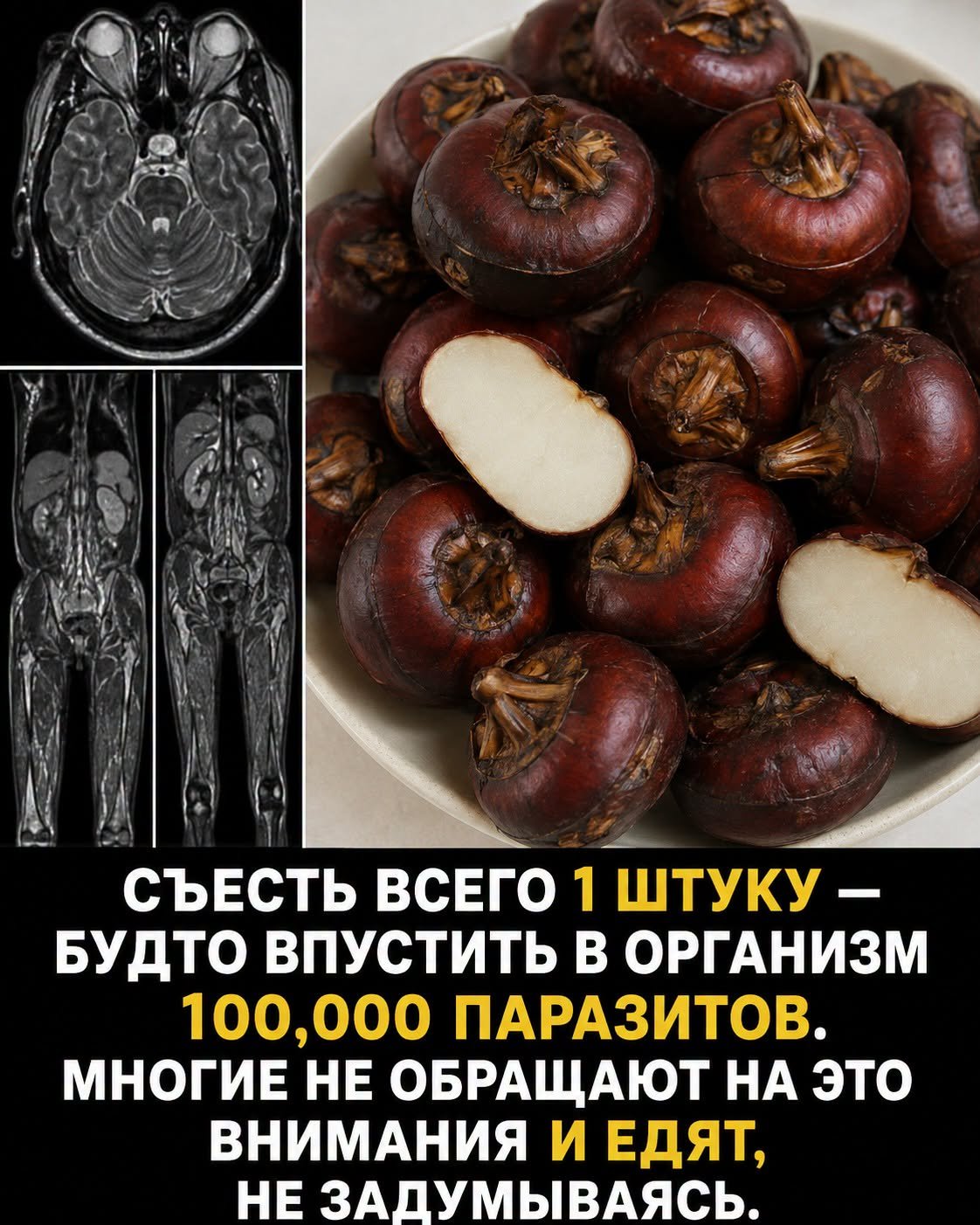 Паразиты могут быть в этих продуктах: что нельзя есть сырым и как защитить себя
