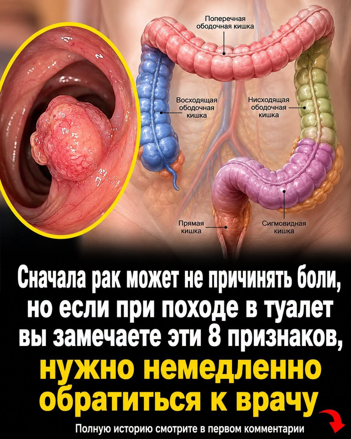 «Они думали, что это пустяк: необычные симптомы, после которых врачи обнаружили рак»