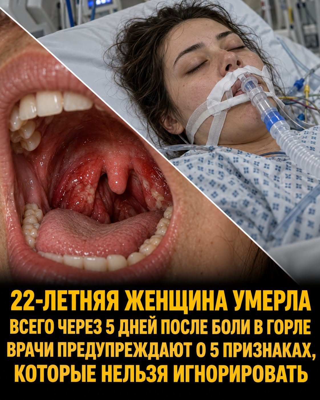 Всего 5 дней от обычной боли в горле до трагедии: 7 тревожных симптомов, которые нельзя игнорировать